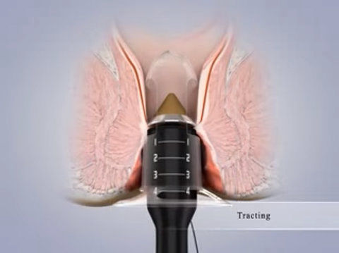 Proctólogos en Chilpancingo